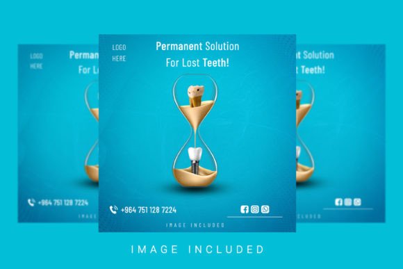 Download Dental Implantation Social Media Post - Social media post Collection